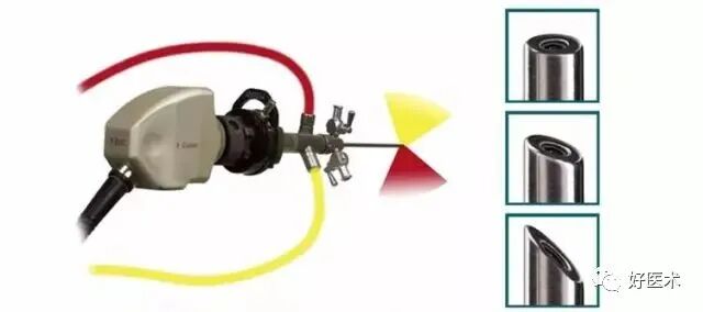 关节镜配套哪些关节镜技术速成诀窍_https://www.jmylbn.com_新闻资讯_第12张