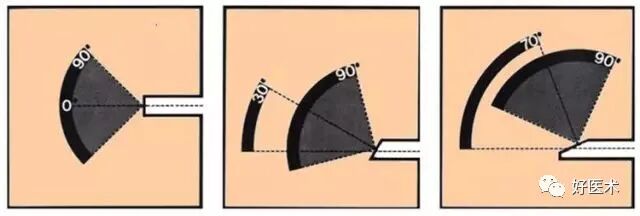 关节镜配套哪些关节镜技术速成诀窍_https://www.jmylbn.com_新闻资讯_第16张