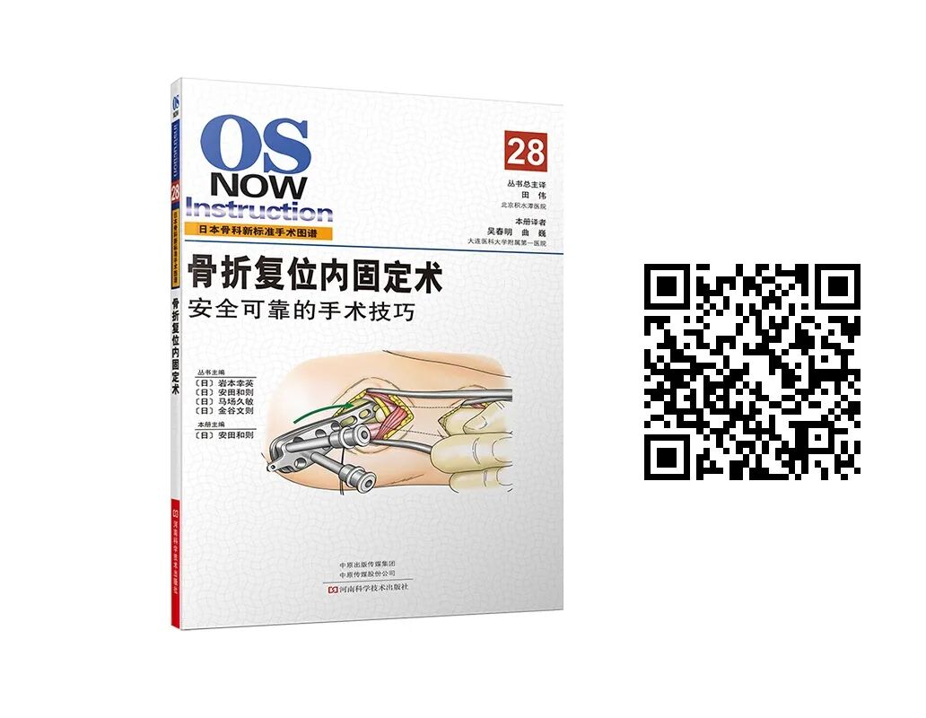 医用头灯国外怎么买【进口定制款】TTL伽利略医用棱镜式放大镜，可配置蝴蝶头灯_https://www.jmylbn.com_新闻资讯_第16张