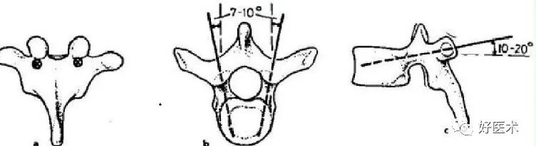 颈、胸、腰椎椎弓根钉置钉技巧，必备高清图解（全）！