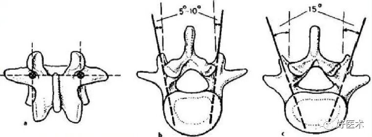 颈、胸、腰椎椎弓根钉置钉技巧，必备高清图解（全）！