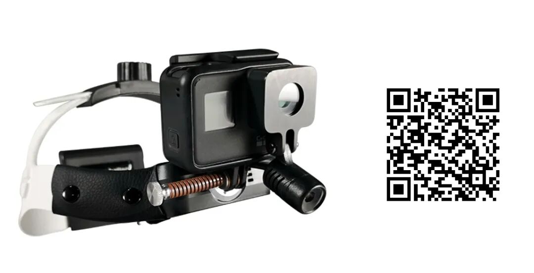 手术头灯眼镜怎么畅销书！Ilizarov 外固定：器械、方法和理念_https://www.jmylbn.com_新闻资讯_第25张