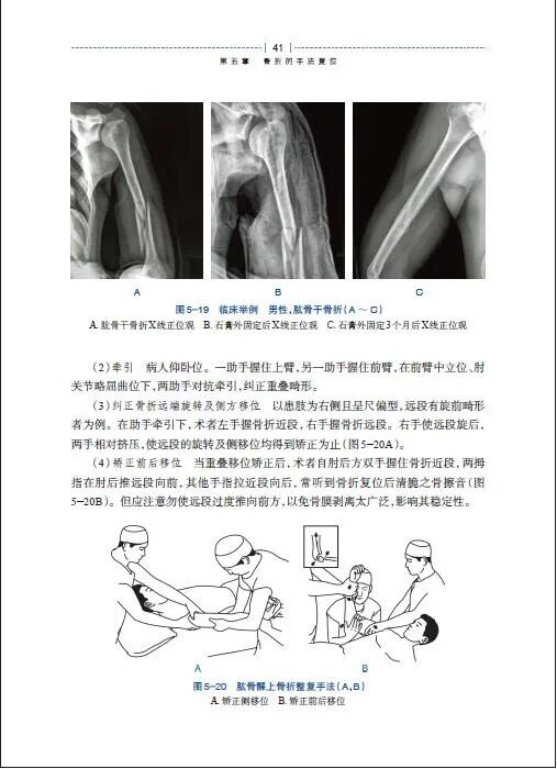 绷带石膏怎么拆除好书 ｜ 手把手教你实用石膏绷带外固定技术，附视频教学！_https://www.jmylbn.com_新闻资讯_第6张