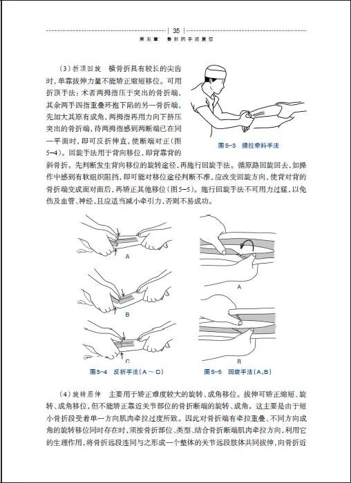 绷带石膏怎么拆除好书 ｜ 手把手教你实用石膏绷带外固定技术，附视频教学！_https://www.jmylbn.com_新闻资讯_第5张
