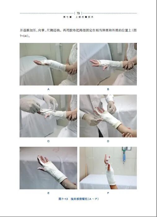 绷带石膏怎么拆除好书 ｜ 手把手教你实用石膏绷带外固定技术，附视频教学！_https://www.jmylbn.com_新闻资讯_第7张