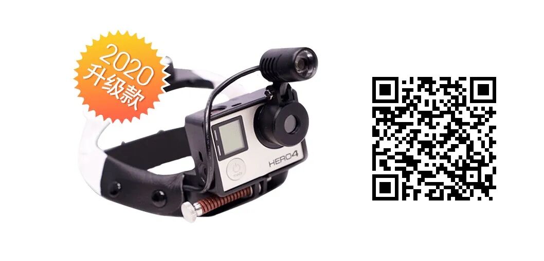 手术头灯眼镜怎么骨科头灯、手术摄像机、放大镜等手术工具每满800减80！_https://www.jmylbn.com_新闻资讯_第5张