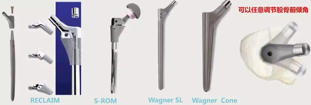 做好初次髋关节置换，这些技巧你掌握了吗？