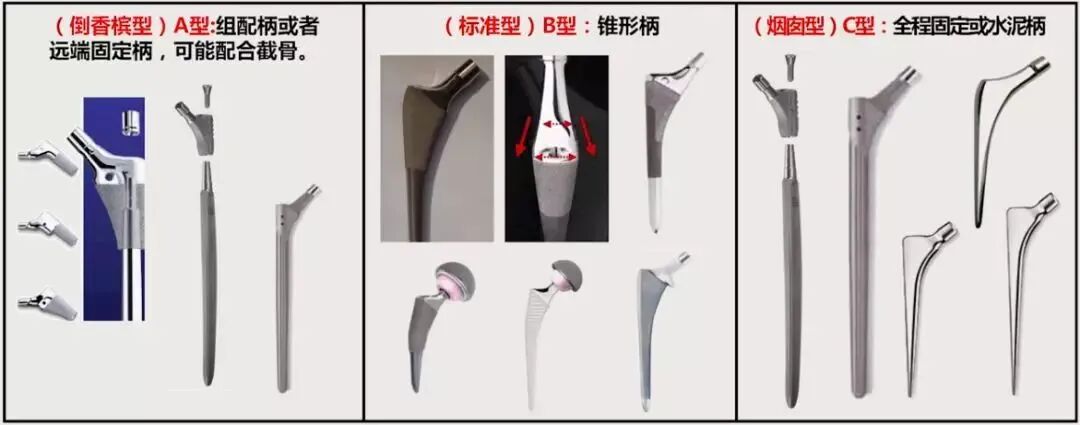 做好初次髋关节置换，这些技巧你掌握了吗？