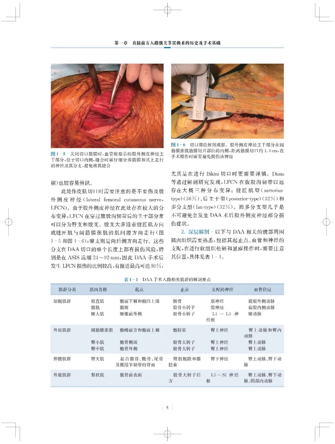 手术头灯眼镜怎么实用专著 ｜ 国内首部介绍直接前方入路微创髋关节置换术书籍_https://www.jmylbn.com_新闻资讯_第7张