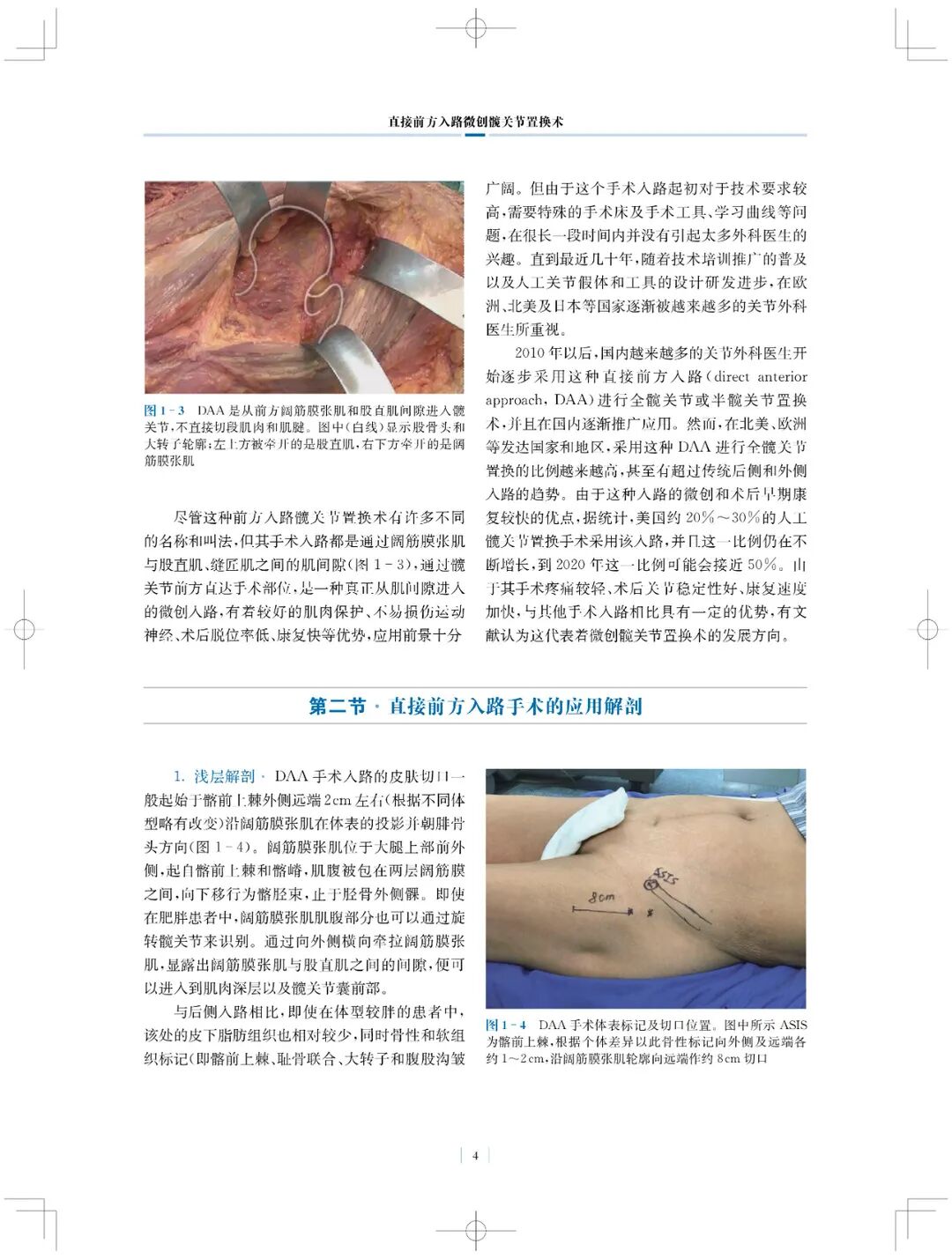手术头灯眼镜怎么实用专著 ｜ 国内首部介绍直接前方入路微创髋关节置换术书籍_https://www.jmylbn.com_新闻资讯_第6张