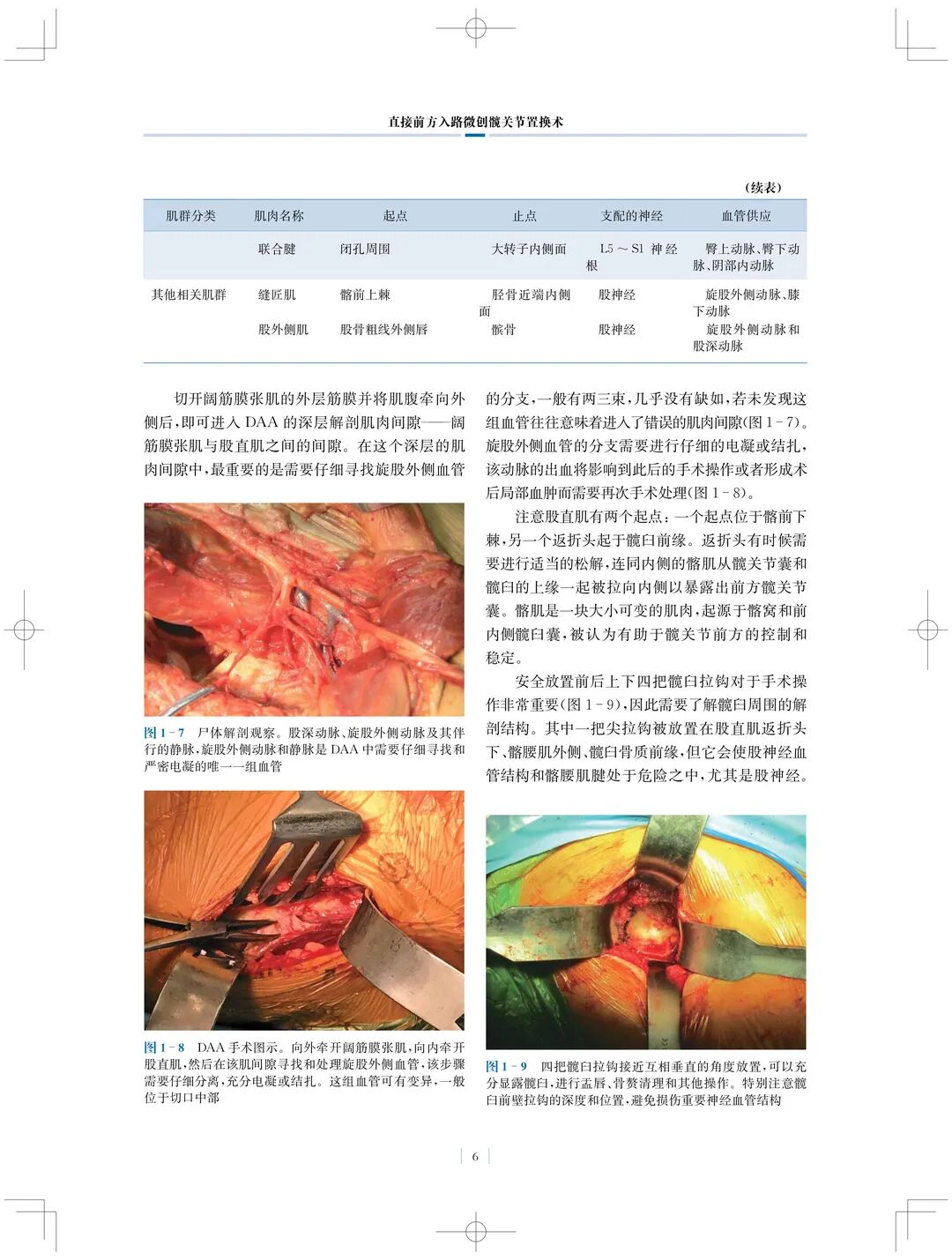 手术头灯眼镜怎么实用专著 ｜ 国内首部介绍直接前方入路微创髋关节置换术书籍_https://www.jmylbn.com_新闻资讯_第8张