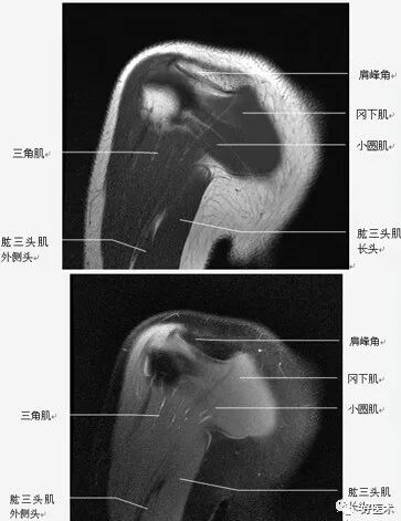 高清影像图解肩关节解剖及诊断