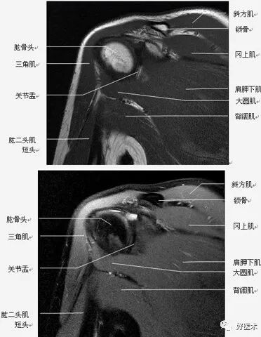 高清影像图解肩关节解剖及诊断