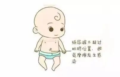 愈脐带怎么用视频断开生命的桥梁，爱依然在—谈谈新生儿脐部那些事_https://www.jmylbn.com_新闻资讯_第8张