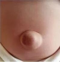 愈脐带怎么用视频断开生命的桥梁，爱依然在—谈谈新生儿脐部那些事_https://www.jmylbn.com_新闻资讯_第6张