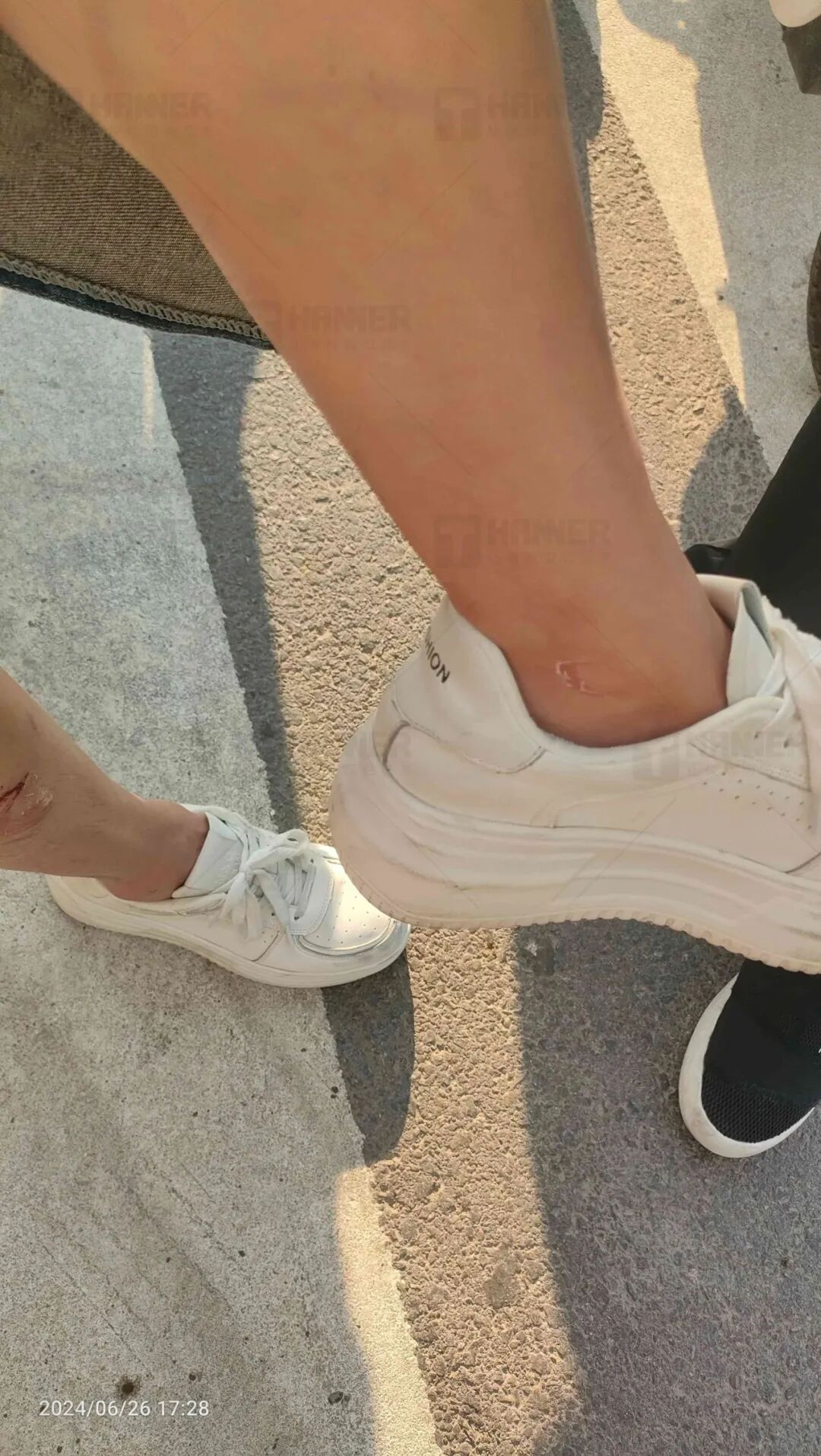 美团女骑手撞伤三者,一个月保险理赔到账