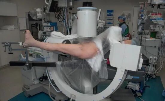 什么是c型臂术中透视骨科精读 ｜ 股骨近端骨折的转子区域与矢状面力线术中透视技巧_https://www.jmylbn.com_新闻资讯_第30张