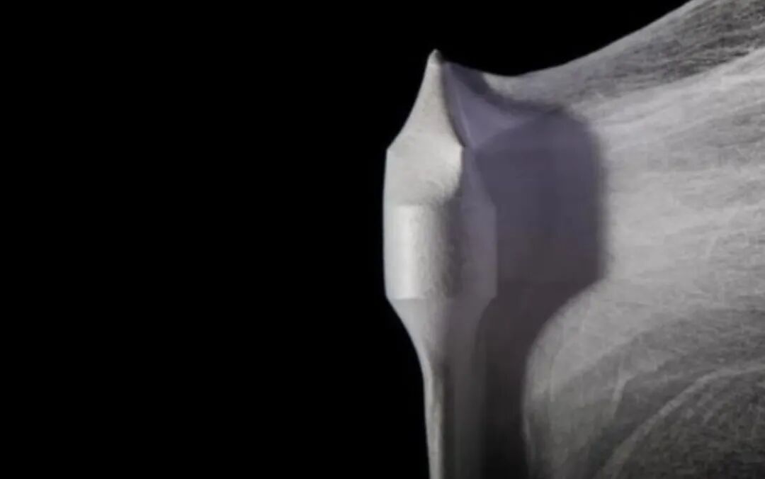 哈佛大学3D打印合成心脏瓣膜，可伴随儿童一起生长，减少手术次数