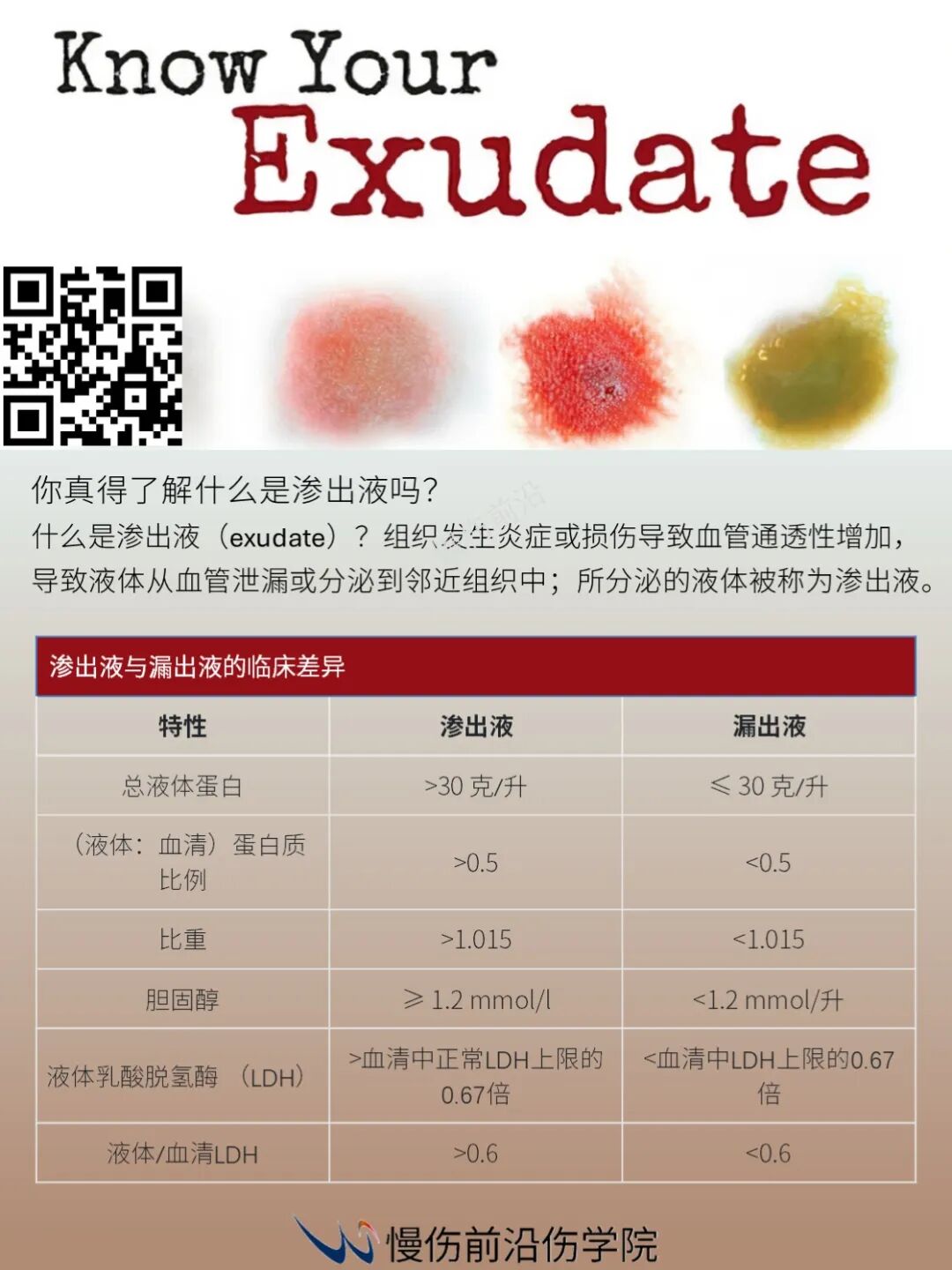 你真得了解什么是渗出液吗?