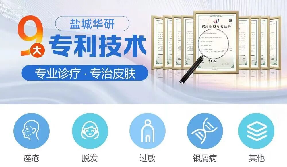 盐城皮肤病医院丨患上牛皮癣有哪些症状？