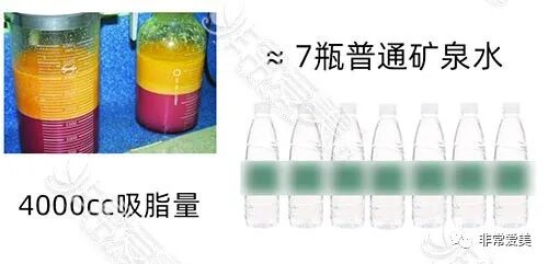 全身抽脂副作用_全身抽脂风险_全身抽脂有什么危害吗