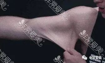 全身抽脂风险_全身抽脂有什么危害吗_全身抽脂副作用