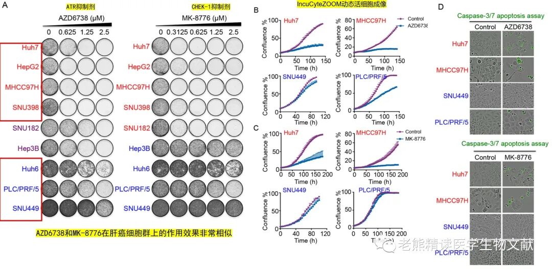 med压力怎么弄Genome Med(IF=11)｜靶向CDC7通过诱导DNA复制压力增强肝癌ATR-CHK1的抑制作用_https://www.jmylbn.com_新闻资讯_第3张