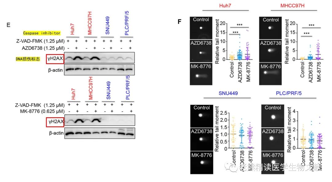 med压力怎么弄Genome Med(IF=11)｜靶向CDC7通过诱导DNA复制压力增强肝癌ATR-CHK1的抑制作用_https://www.jmylbn.com_新闻资讯_第4张