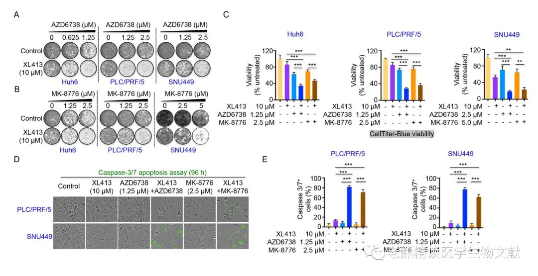 med压力怎么弄Genome Med(IF=11)｜靶向CDC7通过诱导DNA复制压力增强肝癌ATR-CHK1的抑制作用_https://www.jmylbn.com_新闻资讯_第11张