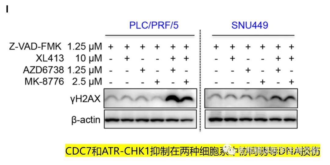 med压力怎么弄Genome Med(IF=11)｜靶向CDC7通过诱导DNA复制压力增强肝癌ATR-CHK1的抑制作用_https://www.jmylbn.com_新闻资讯_第8张