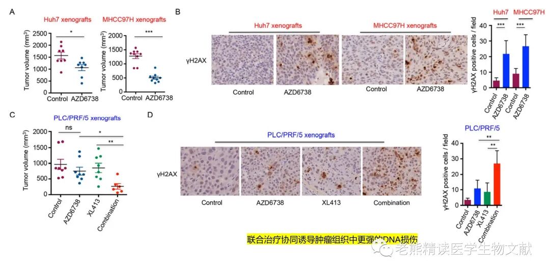med压力怎么弄Genome Med(IF=11)｜靶向CDC7通过诱导DNA复制压力增强肝癌ATR-CHK1的抑制作用_https://www.jmylbn.com_新闻资讯_第14张