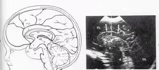 胎儿超声心电图是什么宣 教丨心脏超声的重要性及作用_https://www.jmylbn.com_新闻资讯_第21张