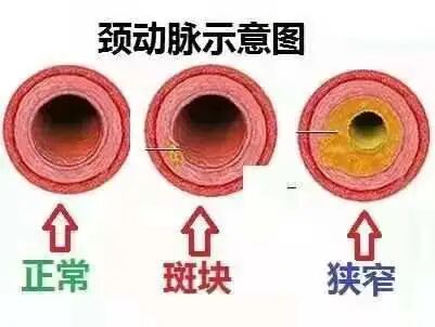 胎儿超声心电图是什么宣 教丨心脏超声的重要性及作用_https://www.jmylbn.com_新闻资讯_第20张