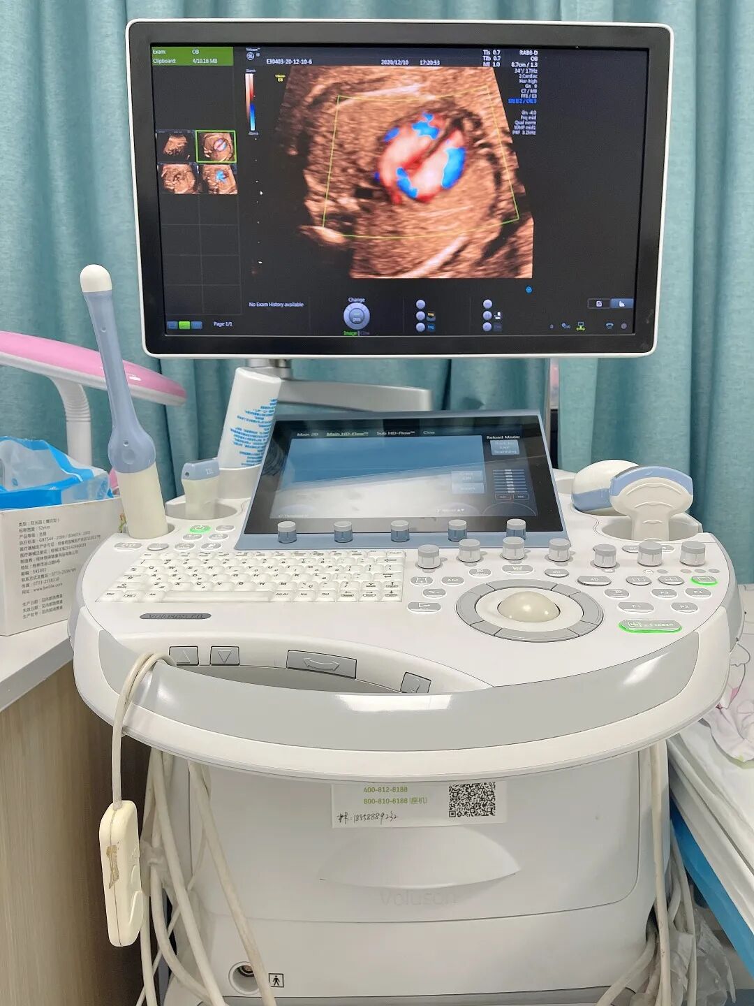 胎儿超声心电图是什么宣 教丨心脏超声的重要性及作用_https://www.jmylbn.com_新闻资讯_第14张