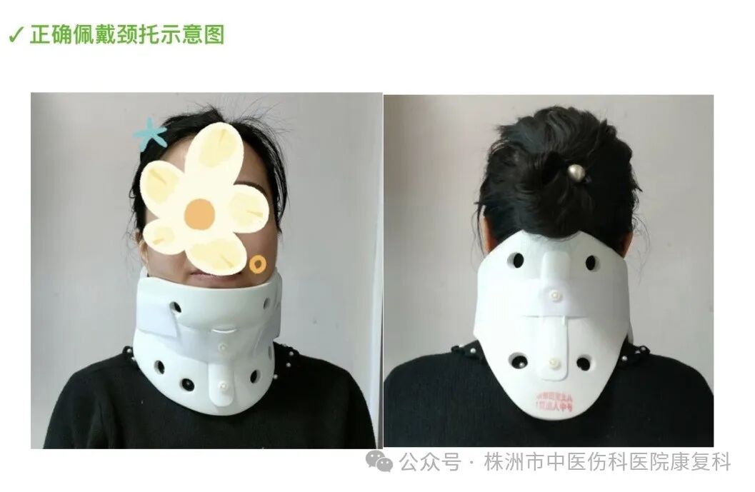 医用颈托怎么戴颈托从选择到护理，护士必知！_https://www.jmylbn.com_新闻资讯_第10张