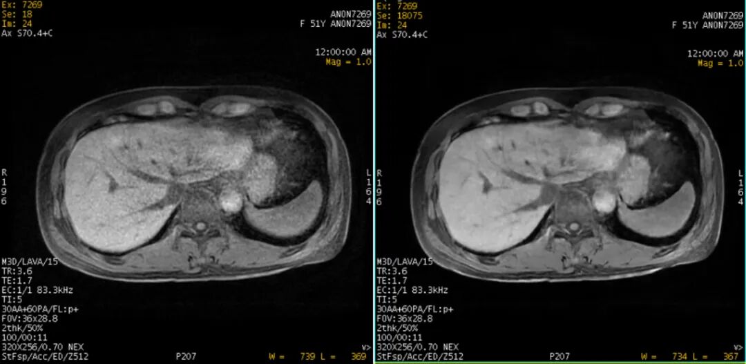 i什么是什么医疗设备快速、清晰、高效：GE医疗推出划时代的磁共振“心”技术_https://www.jmylbn.com_新闻资讯_第3张