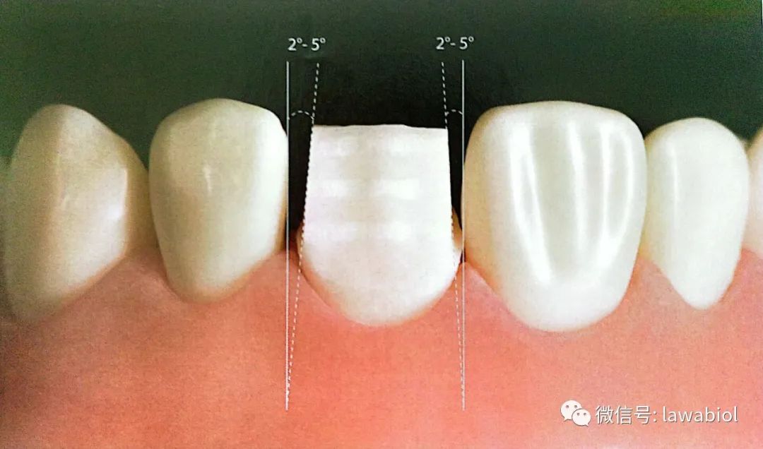 前牙三类洞型预备图片图片