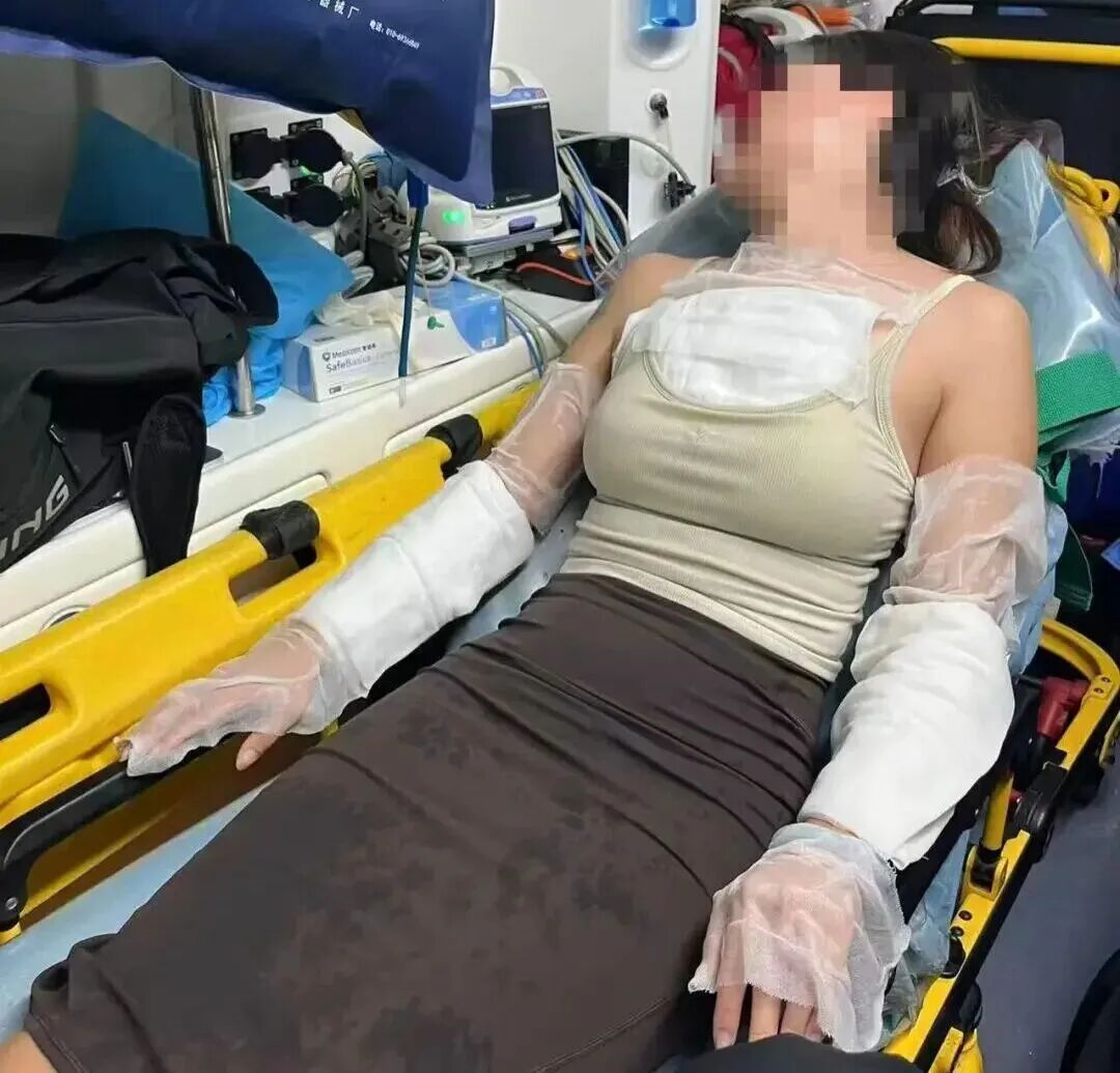 向顾客泼开水被行拘