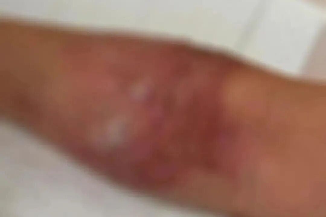 向顾客泼开水被行拘