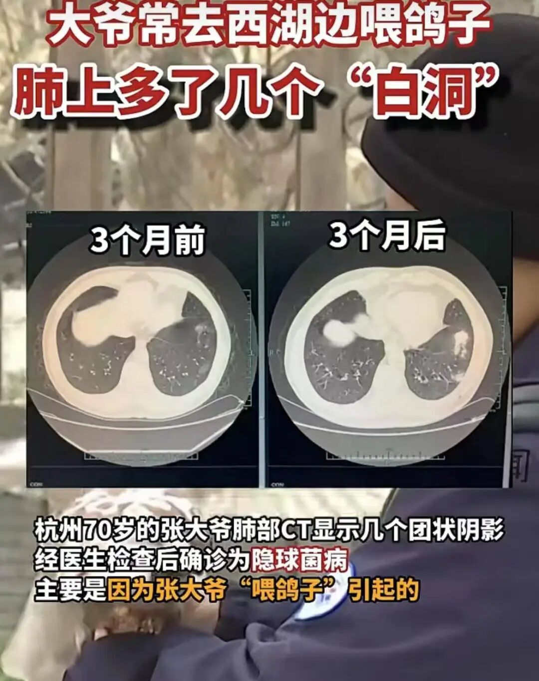 日大街天降老鼠伤人