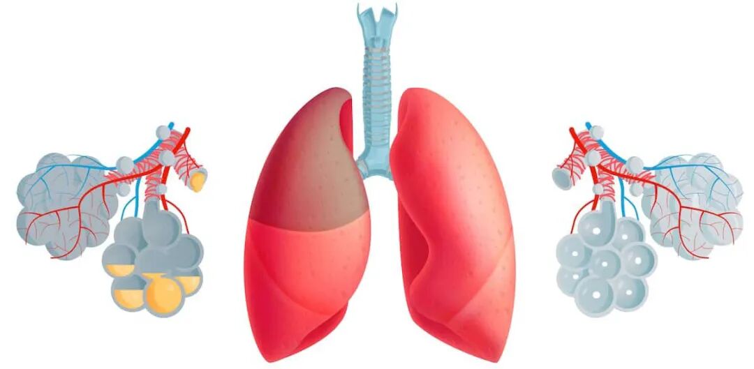 呼吸机湿化罐怎么加水谢克亮教授：ICU机械通气中的湿化与感控_https://www.jmylbn.com_新闻资讯_第1张