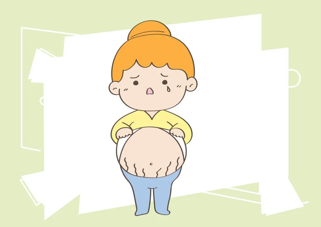 医维他活性叶酸妊娠纹也是挑人的这几类孕妈要小心了