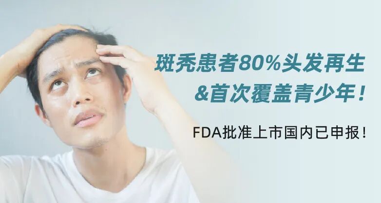 斑秃患者80%头发再生&首次覆盖青少年！FDA批准上市国内已申报！