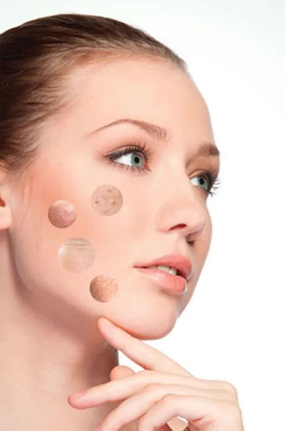 Histomer海皙曼护肤Tips | 夏季如何正确使用爽肤水？