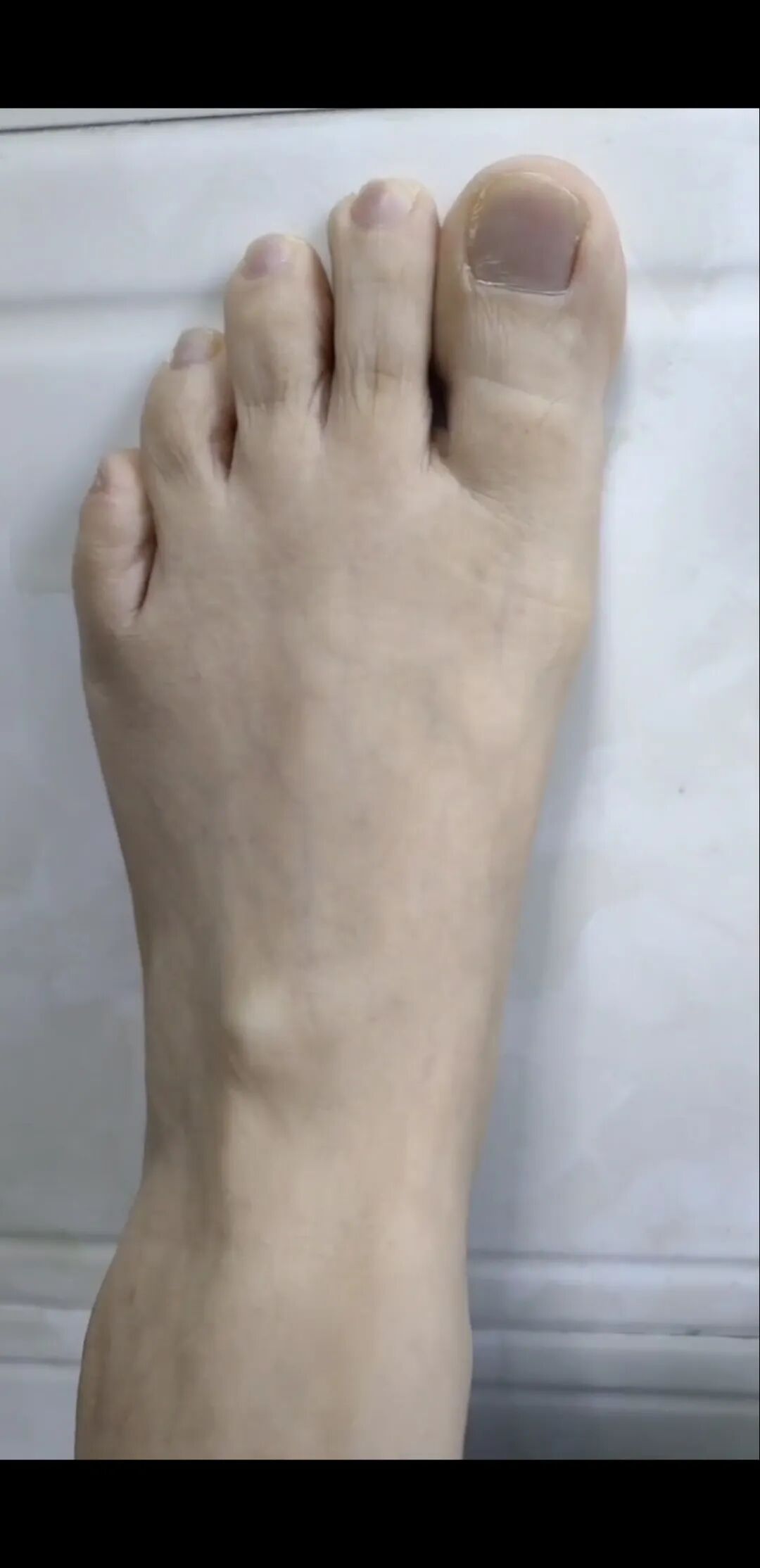 超声波治疗是什么什么是超声波治疗，有什么作用？_https://www.jmylbn.com_新闻资讯_第11张