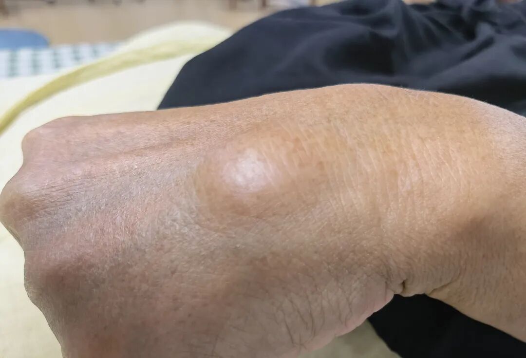 超声波治疗是什么什么是超声波治疗，有什么作用？_https://www.jmylbn.com_新闻资讯_第10张