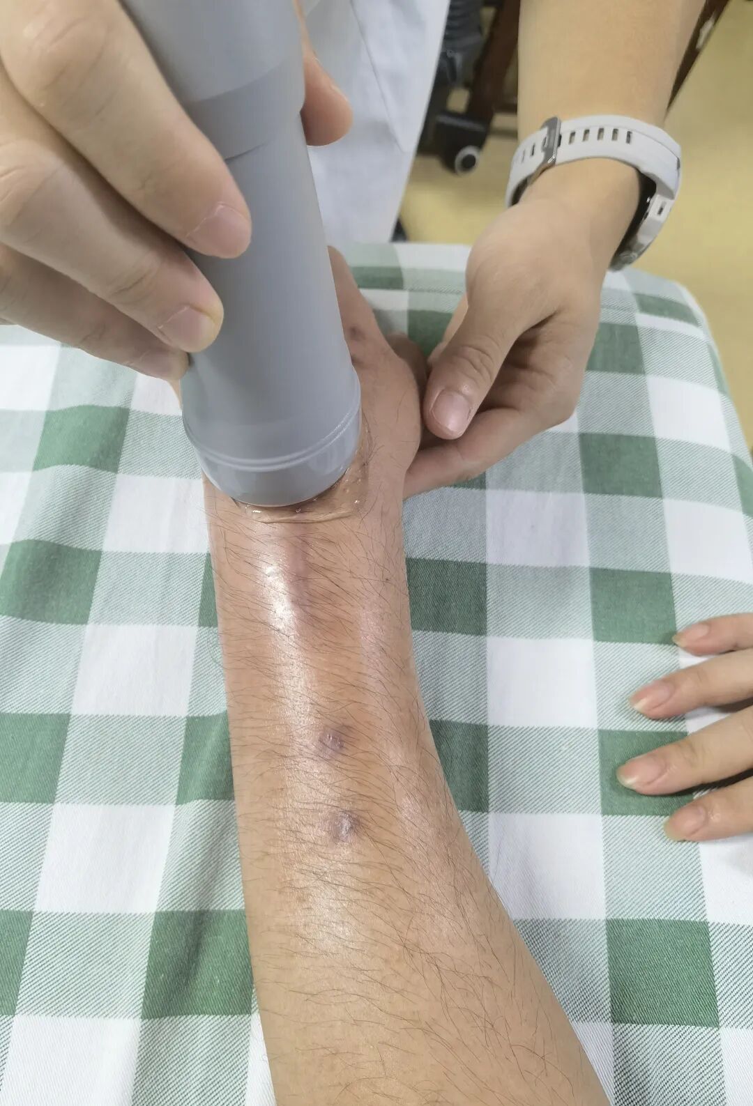 超声波治疗是什么什么是超声波治疗，有什么作用？_https://www.jmylbn.com_新闻资讯_第7张