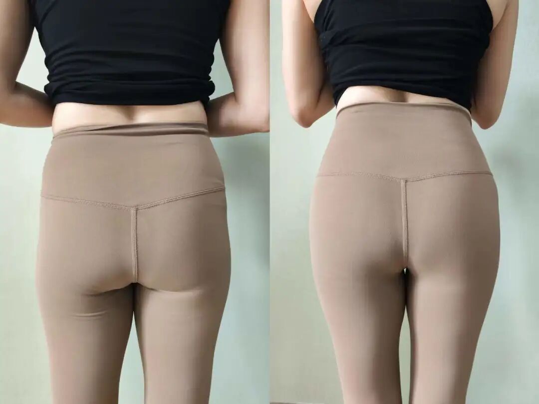 泽玉臀雕十分擅长改善臀凹陷,妈妈臀,蝴蝶臀,臀下垂等各种各样的臀部