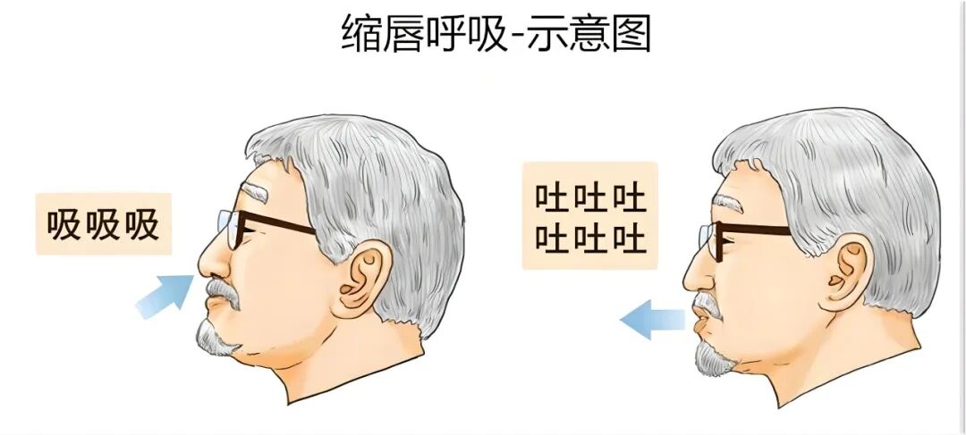 什么是气体陷闭慢阻肺患者如何正确进行缩唇呼吸？【海河科普】_https://www.jmylbn.com_新闻资讯_第4张