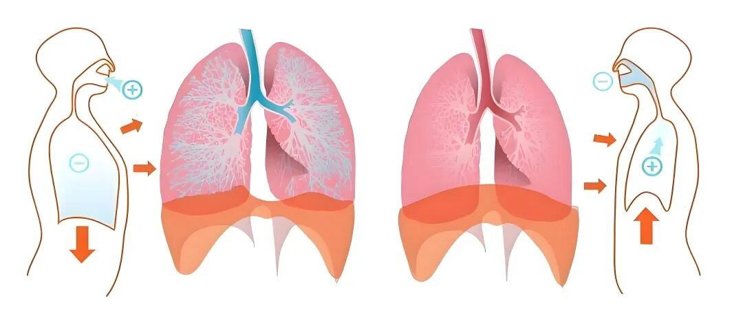 什么是气体陷闭慢阻肺患者如何正确进行缩唇呼吸？【海河科普】_https://www.jmylbn.com_新闻资讯_第6张